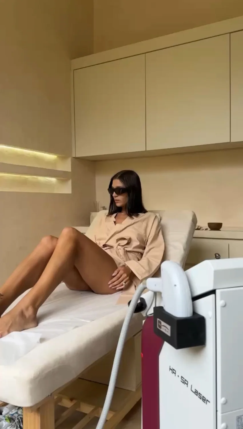 Upper lip laser